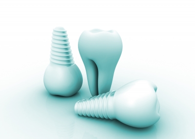 Dental Implants Cache valley